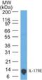 Interleukin 17 Receptor E antibody, NBP2-27368, Novus Biologicals, Western Blot image 