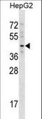 T-box transcription factor TBX20 antibody, LS-C157153, Lifespan Biosciences, Western Blot image 