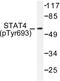 Signal Transducer And Activator Of Transcription 4 antibody, LS-C177956, Lifespan Biosciences, Western Blot image 