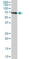 Zinc Finger Protein 461 antibody, H00092283-B01P, Novus Biologicals, Western Blot image 