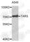 SYTC antibody, A4139, ABclonal Technology, Western Blot image 