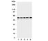 Matrix Metallopeptidase 12 antibody, R31265, NSJ Bioreagents, Western Blot image 