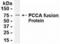 Propionyl-CoA Carboxylase Subunit Alpha antibody, XW-7764, ProSci, Western Blot image 