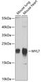Myosin Light Chain 7 antibody, 19-495, ProSci, Western Blot image 