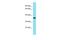 Sosondowah Ankyrin Repeat Domain Family Member D antibody, A19468, Boster Biological Technology, Western Blot image 