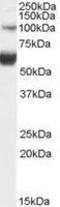 HNF1 Homeobox B antibody, GTX89168, GeneTex, Western Blot image 