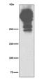 MUC5 antibody, M00612-1, Boster Biological Technology, Western Blot image 