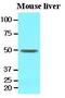 Epoxide Hydrolase 1 antibody, GTX53710, GeneTex, Western Blot image 