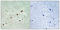 Protein Kinase, DNA-Activated, Catalytic Subunit antibody, A00645S2612, Boster Biological Technology, Immunohistochemistry paraffin image 