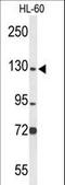 Minichromosome Maintenance Complex Component 2 antibody, LS-C164090, Lifespan Biosciences, Western Blot image 