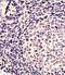 Engrailed Homeobox 1 antibody, GTX81554, GeneTex, Immunohistochemistry paraffin image 