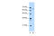 Involucrin antibody, 30-432, ProSci, Enzyme Linked Immunosorbent Assay image 