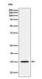 Mago Homolog, Exon Junction Complex Subunit antibody, M04427, Boster Biological Technology, Western Blot image 