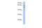 Transmembrane And Coiled-Coil Domain Family 3 antibody, GTX46046, GeneTex, Western Blot image 