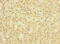 DIS3 Like Exosome 3'-5' Exoribonuclease antibody, CSB-PA823476LA01HU, Cusabio, Immunohistochemistry paraffin image 