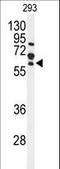 Frizzled Class Receptor 4 antibody, LS-C166296, Lifespan Biosciences, Western Blot image 