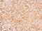 Mannosidase Endo-Alpha antibody, NBP2-17214, Novus Biologicals, Immunohistochemistry frozen image 