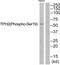 Tryptophan hydroxylase 2 antibody, PA5-37803, Invitrogen Antibodies, Western Blot image 