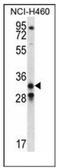 MIC-1 antibody, AP51810PU-N, Origene, Western Blot image 