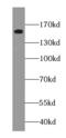 G Protein-Coupled Receptor Associated Sorting Protein 1 antibody, FNab03612, FineTest, Western Blot image 