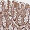 Mastermind Like Transcriptional Coactivator 3 antibody, PA5-58073, Invitrogen Antibodies, Immunohistochemistry paraffin image 