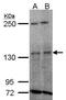 Tyrosine Kinase 2 antibody, TA308735, Origene, Western Blot image 