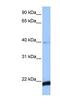 HBS1 Like Translational GTPase antibody, NBP1-52835, Novus Biologicals, Western Blot image 