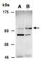 Signal Transducer And Activator Of Transcription 5B antibody, orb67261, Biorbyt, Western Blot image 