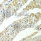 Serpin Family H Member 1 antibody, A2517, ABclonal Technology, Immunohistochemistry paraffin image 