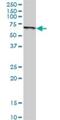 Solute Carrier Family 45 Member 2 antibody, H00051151-D01P, Novus Biologicals, Western Blot image 