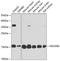 NADH:Ubiquinone Oxidoreductase Subunit B5 antibody, A10585, Boster Biological Technology, Western Blot image 