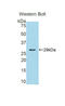 Catechol-O-Methyltransferase antibody, LS-C293235, Lifespan Biosciences, Western Blot image 