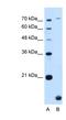 Transmembrane Protein 91 antibody, NBP1-70731, Novus Biologicals, Western Blot image 