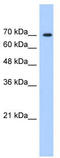 LAS1 Like, Ribosome Biogenesis Factor antibody, TA337261, Origene, Western Blot image 