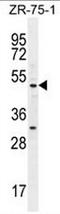 Myocyte Enhancer Factor 2D antibody, AP52662PU-N, Origene, Western Blot image 