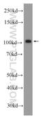 BRCA1 DNA Repair Associated antibody, 22362-1-AP, Proteintech Group, Western Blot image 