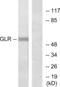 Glucagon Receptor antibody, abx015291, Abbexa, Western Blot image 