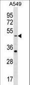 Gamma-Aminobutyric Acid Type A Receptor Rho2 Subunit antibody, LS-C159698, Lifespan Biosciences, Western Blot image 