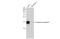 Anterior Gradient 2, Protein Disulphide Isomerase Family Member antibody, GTX135343, GeneTex, Western Blot image 