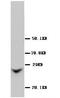 Connexin-26 antibody, PA1025, Boster Biological Technology, Western Blot image 