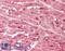 MYB Proto-Oncogene, Transcription Factor antibody, LS-B11880, Lifespan Biosciences, Immunohistochemistry frozen image 