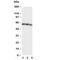 CD40 Molecule antibody, R30193, NSJ Bioreagents, Western Blot image 