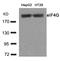 Eukaryotic Translation Initiation Factor 4 Gamma 1 antibody, GTX50653, GeneTex, Western Blot image 