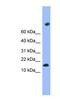 Transmembrane Protein 42 antibody, NBP1-57740, Novus Biologicals, Western Blot image 