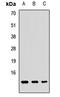 Guanylate Cyclase Activator 2A antibody, LS-B15839, Lifespan Biosciences, Western Blot image 