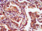 Laminin subunit gamma-2 antibody, CSB-PA618803LA01HU, Cusabio, Immunohistochemistry frozen image 