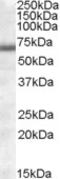 Collagen Type IV Alpha 3 Binding Protein antibody, LS-C87354, Lifespan Biosciences, Western Blot image 