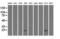 Crystallin Alpha B antibody, LS-C797096, Lifespan Biosciences, Western Blot image 