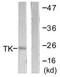 Thymidine Kinase 1 antibody, TA314626, Origene, Western Blot image 