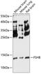 Follicle Stimulating Hormone Subunit Beta antibody, 15-589, ProSci, Western Blot image 